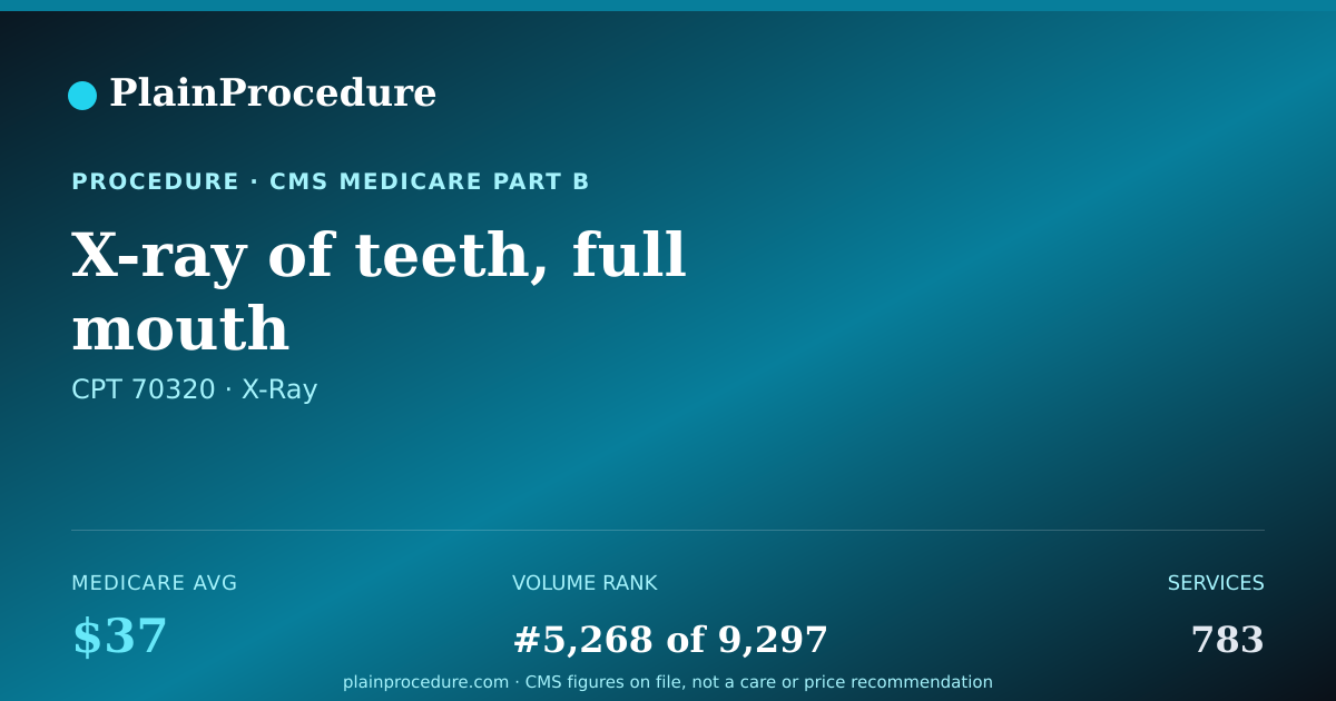 Shareable card for X-Ray Of Teeth, Full Mouth