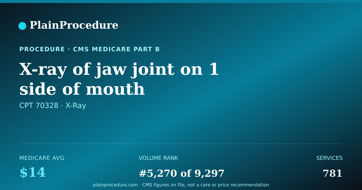 Shareable card for X-Ray Of Jaw Joint On 1 Side Of Mouth