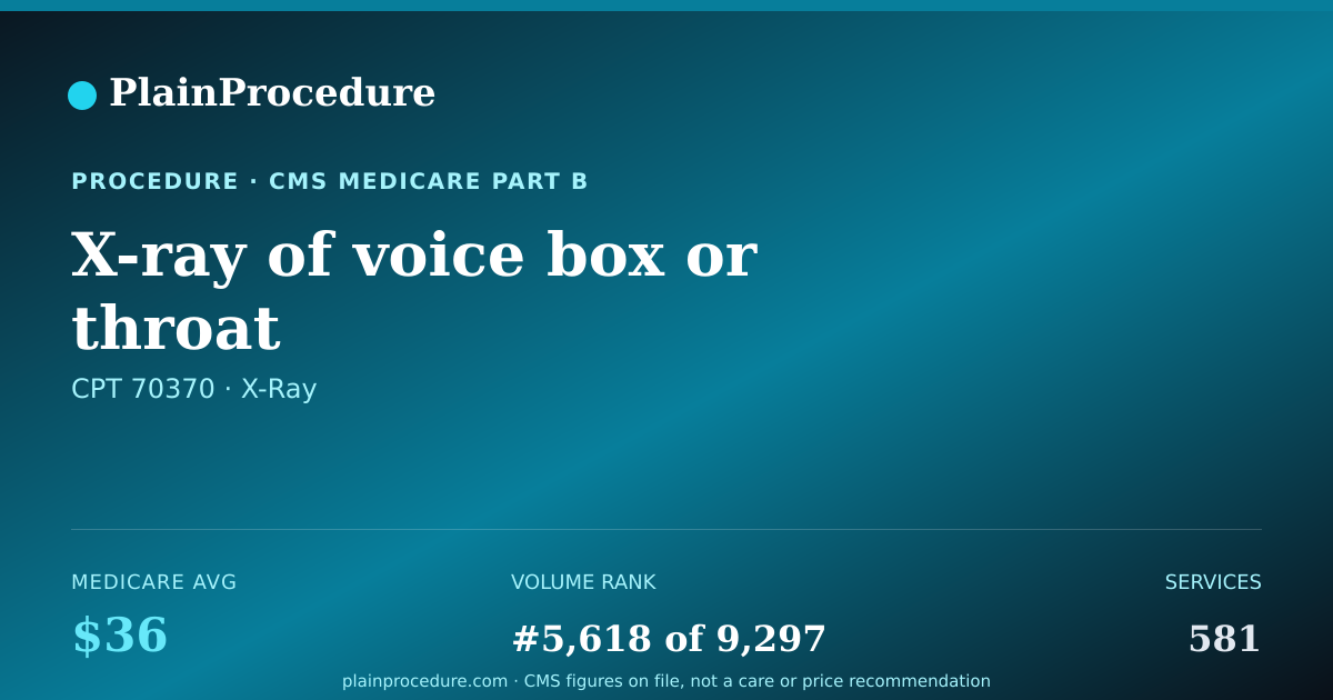 Shareable card for X-Ray Of Voice Box Or Throat