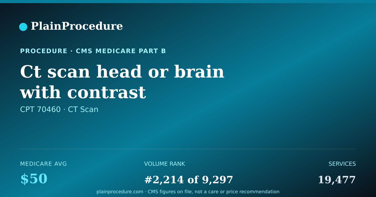 Shareable card for Ct Scan Head Or Brain With Contrast