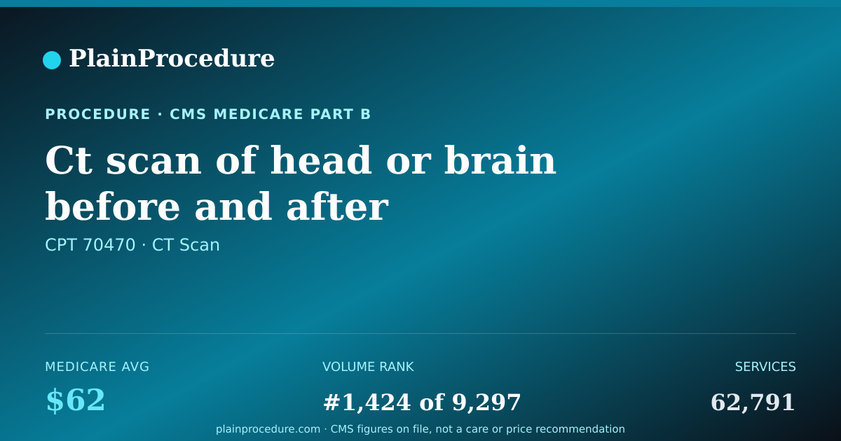 Shareable card for Ct Scan Of Head Or Brain Before And After Contrast