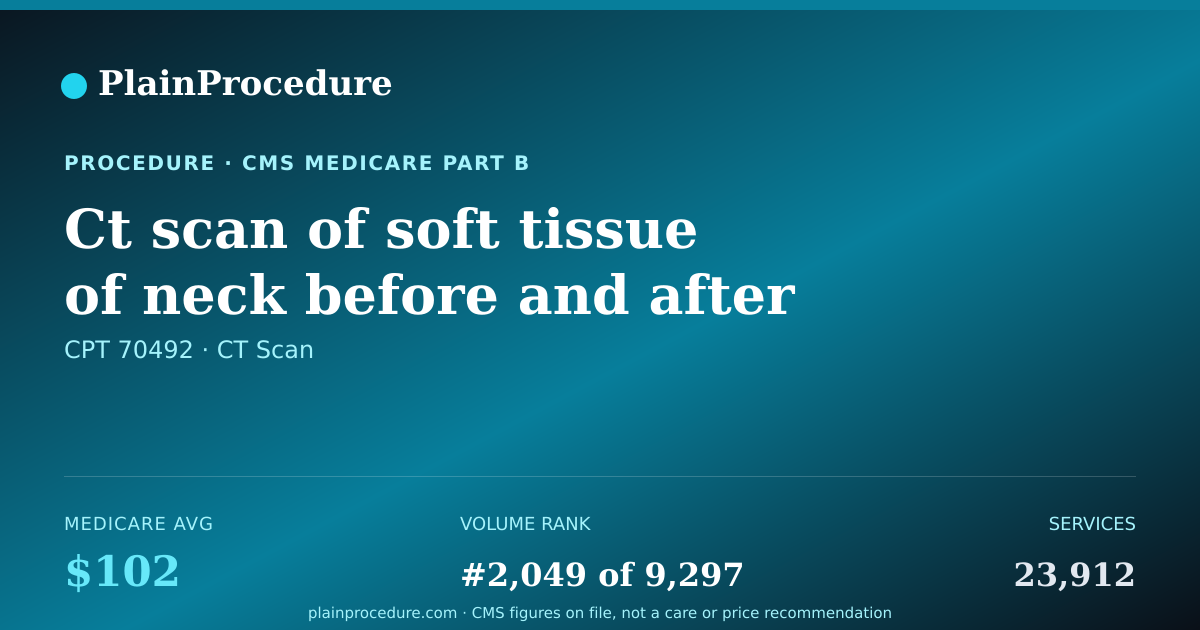 Shareable card for Ct Scan Of Soft Tissue Of Neck Before And After Contrast