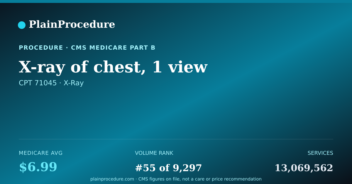 Shareable card for X-Ray Of Chest, 1 View