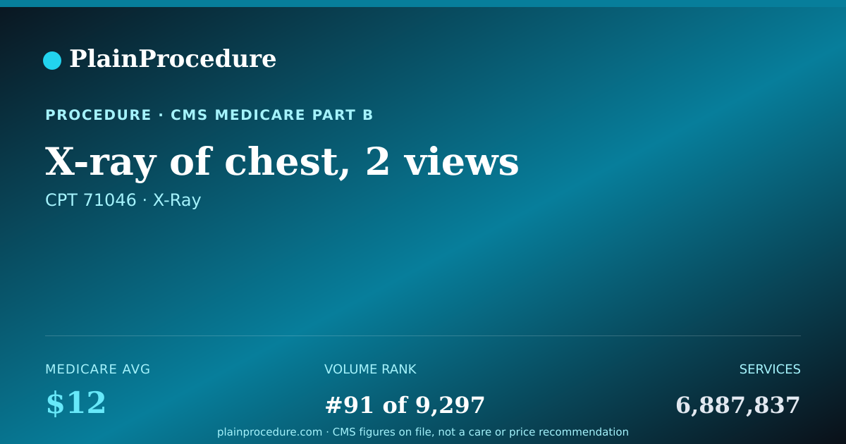 Shareable card for X-Ray Of Chest, 2 Views