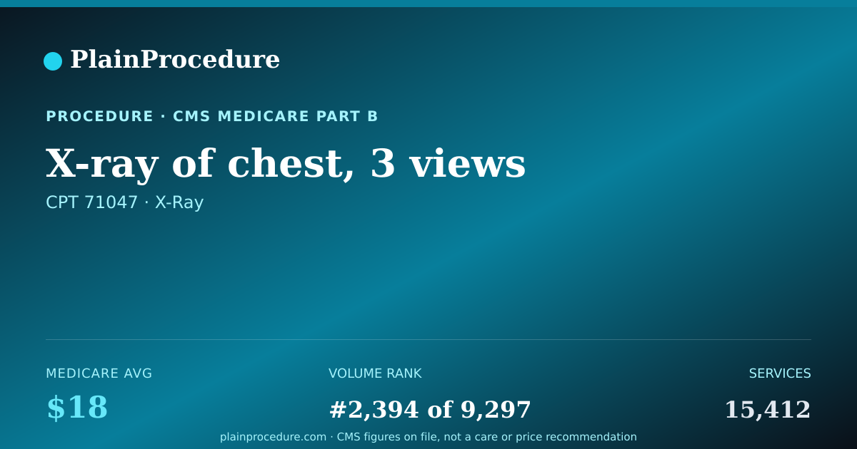 Shareable card for X-Ray Of Chest, 3 Views