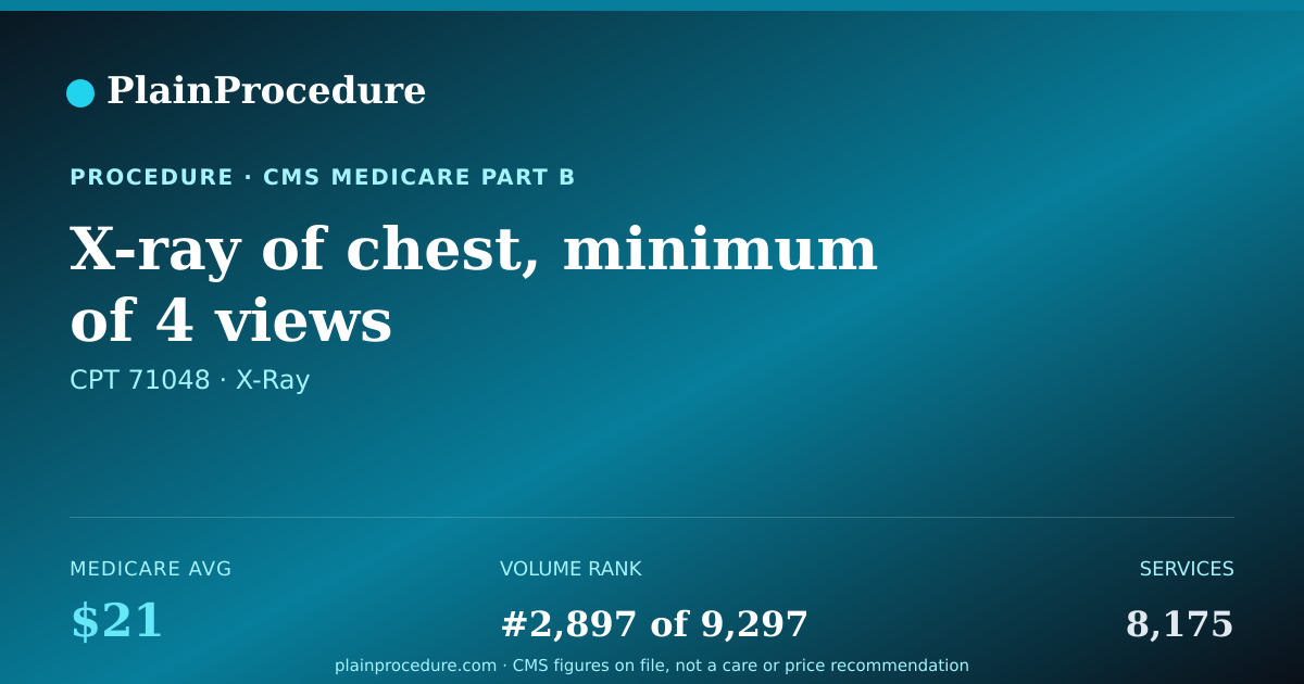 Shareable card for X-Ray Of Chest, Minimum Of 4 Views