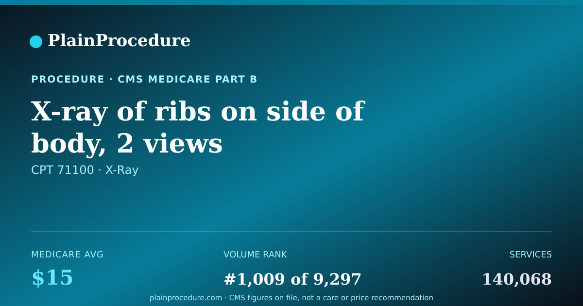 Shareable card for X-Ray Of Ribs On Side Of Body, 2 Views