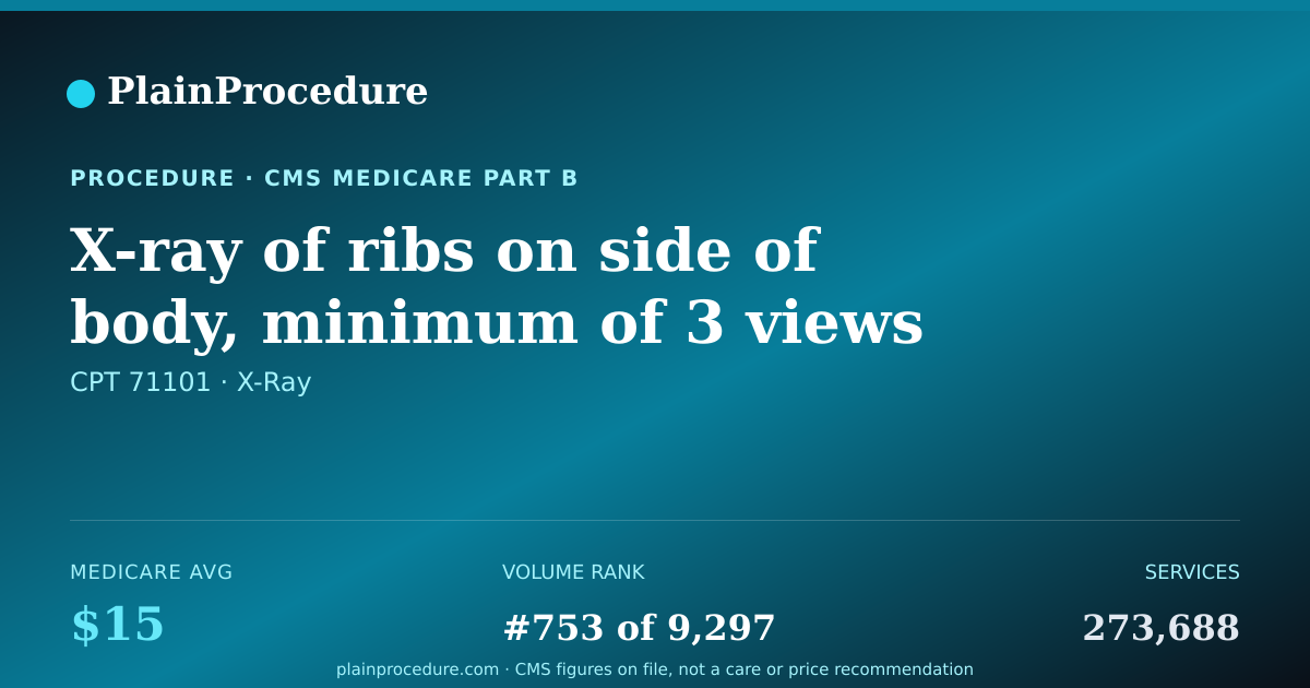 Shareable card for X-Ray Of Ribs On Side Of Body, Minimum Of 3 Views