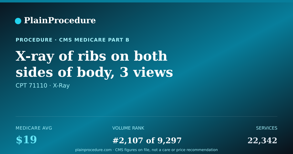 Shareable card for X-Ray Of Ribs On Both Sides Of Body, 3 Views