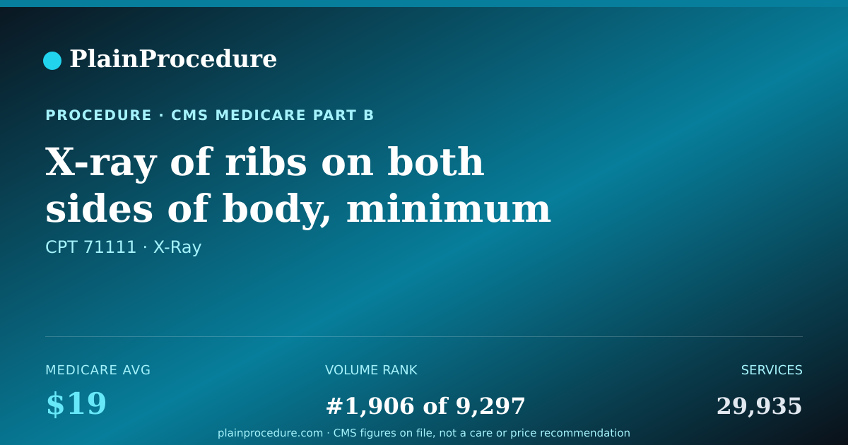 Shareable card for X-Ray Of Ribs On Both Sides Of Body, Minimum Of 4 Views