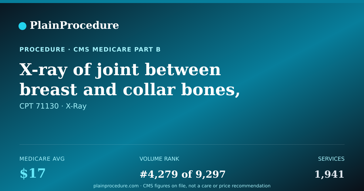 Shareable card for X-Ray Of Joint Between Breast And Collar Bones, Minimum Of 2 Views