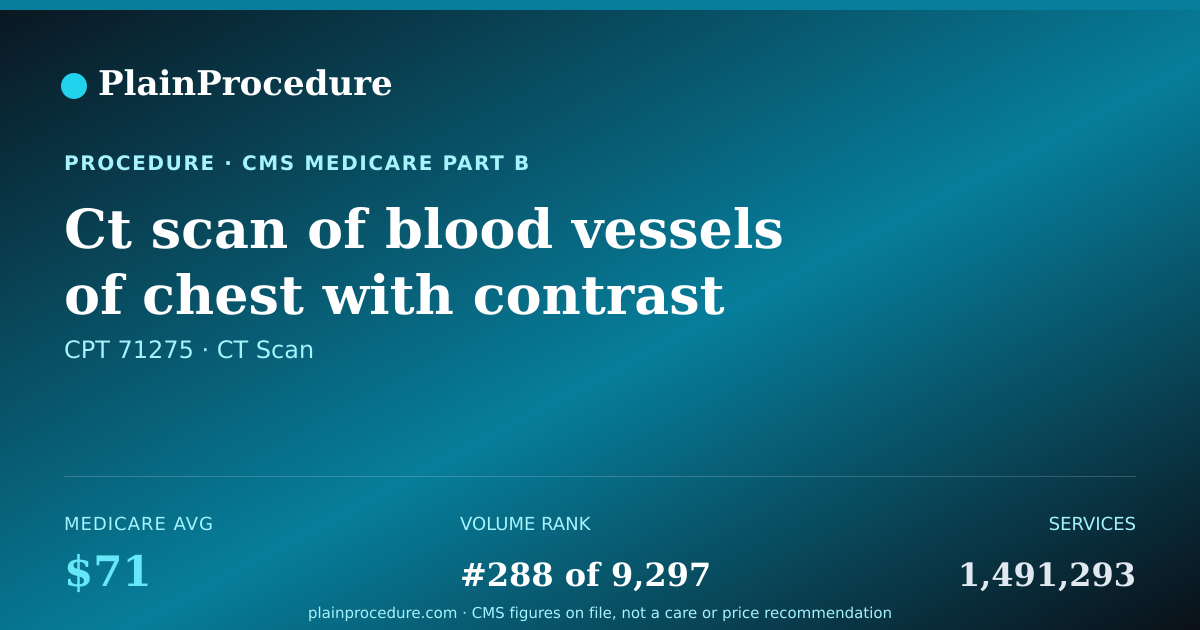Shareable card for Ct Scan Of Blood Vessels Of Chest With Contrast