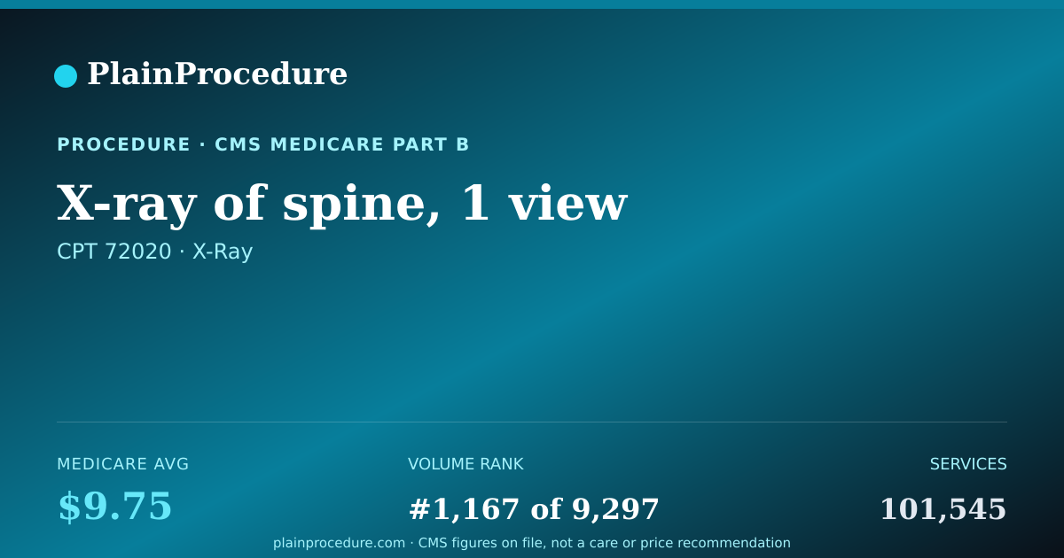 Shareable card for X-Ray Of Spine, 1 View