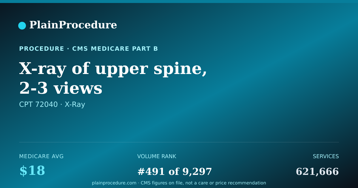 Shareable card for X-Ray Of Upper Spine, 2-3 Views