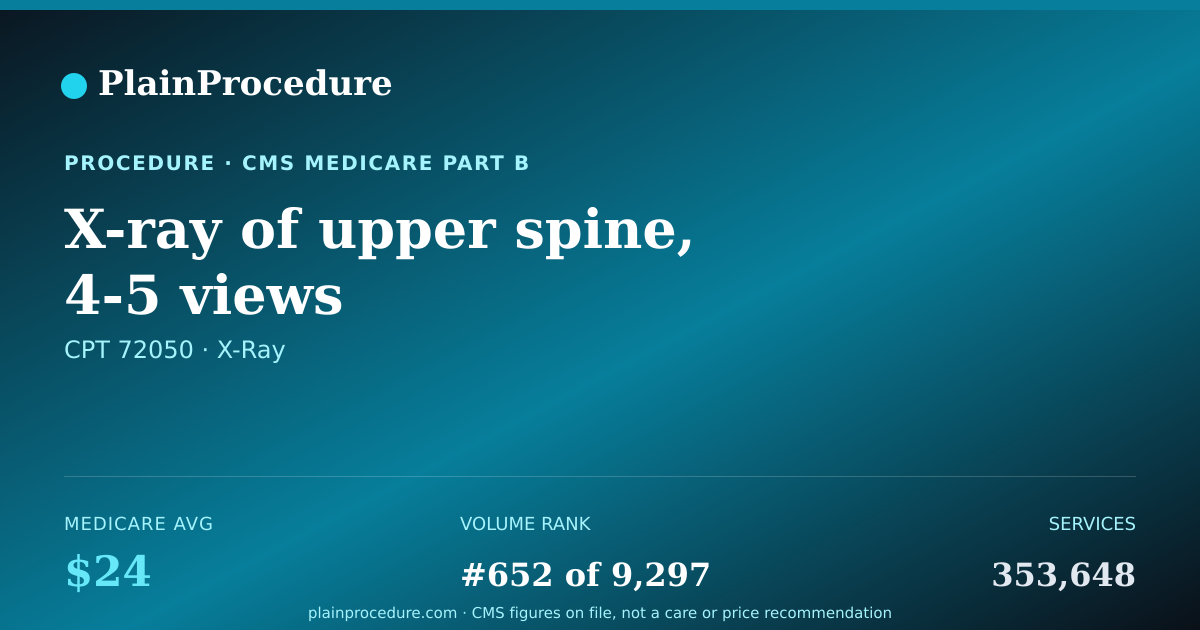 Shareable card for X-Ray Of Upper Spine, 4-5 Views