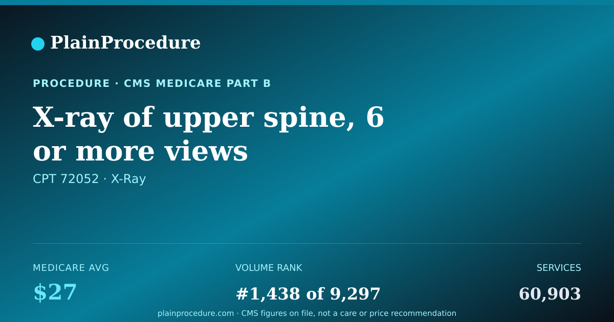 Shareable card for X-Ray Of Upper Spine, 6 Or More Views