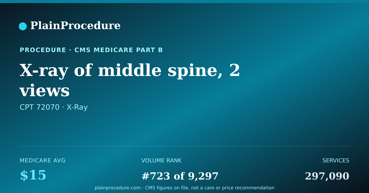 Shareable card for X-Ray Of Middle Spine, 2 Views