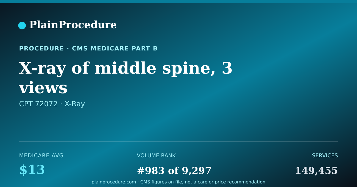 Shareable card for X-Ray Of Middle Spine, 3 Views