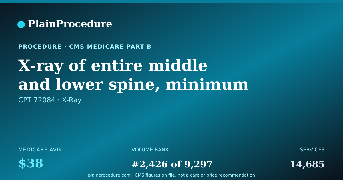 Shareable card for X-Ray Of Entire Middle And Lower Spine, Minimum Of 6 Views