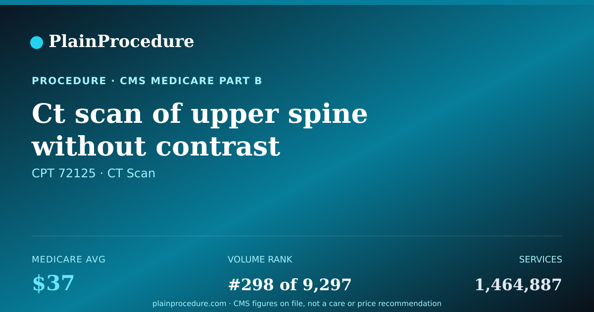 Shareable card for Ct Scan Of Upper Spine Without Contrast