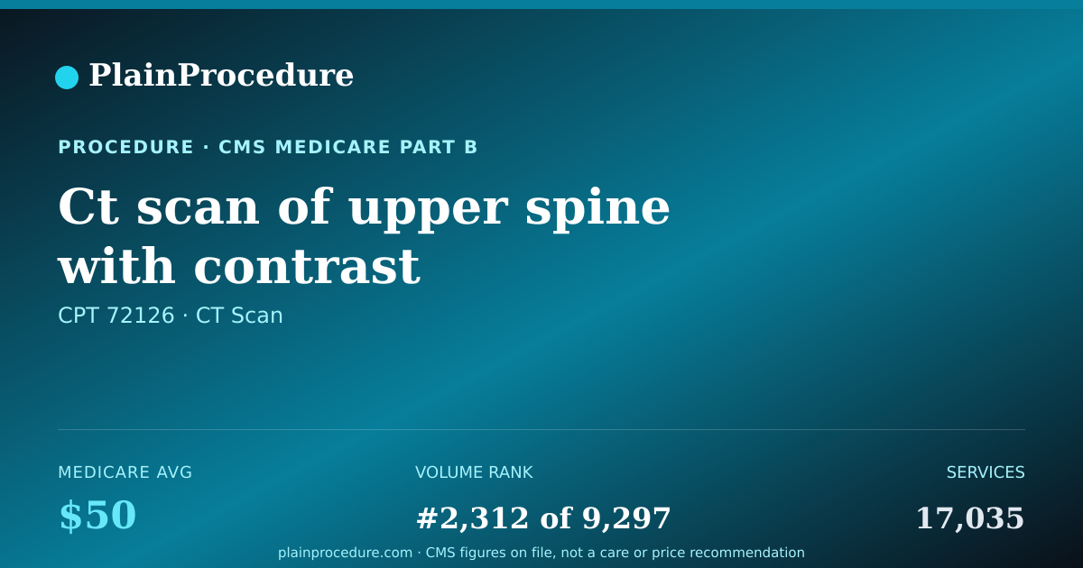 Shareable card for Ct Scan Of Upper Spine With Contrast
