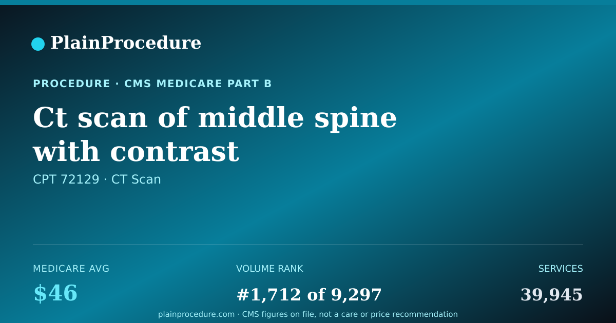 Shareable card for Ct Scan Of Middle Spine With Contrast