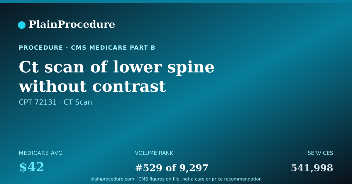 Shareable card for Ct Scan Of Lower Spine Without Contrast