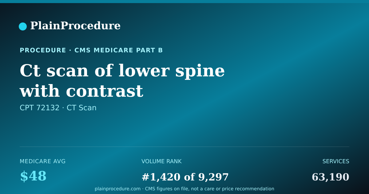 Shareable card for Ct Scan Of Lower Spine With Contrast