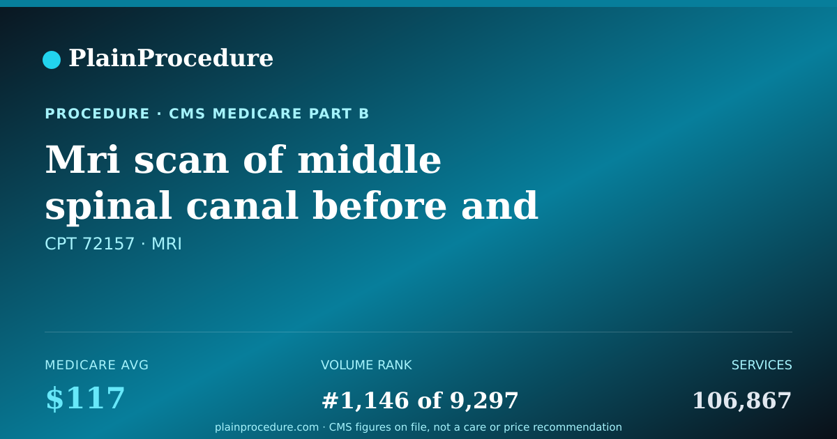 Shareable card for Mri Scan Of Middle Spinal Canal Before And After Contrast