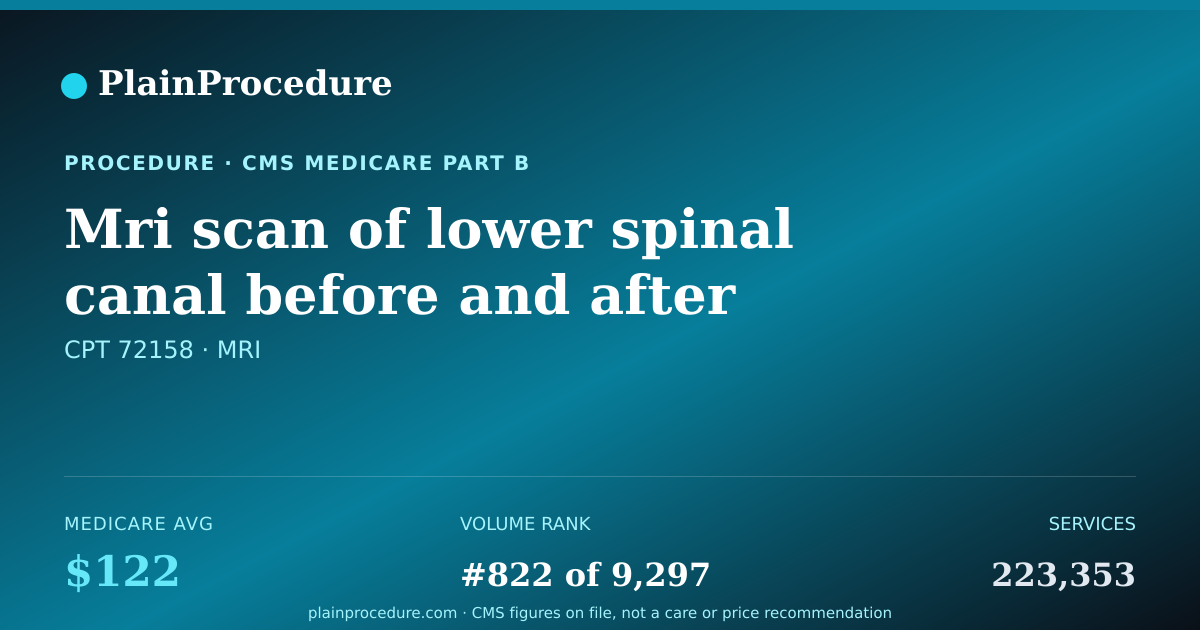 Shareable card for Mri Scan Of Lower Spinal Canal Before And After Contrast