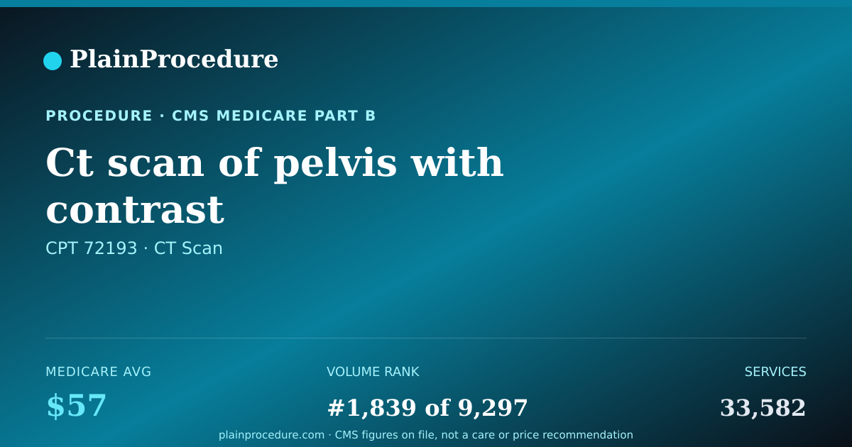 Shareable card for Ct Scan Of Pelvis With Contrast