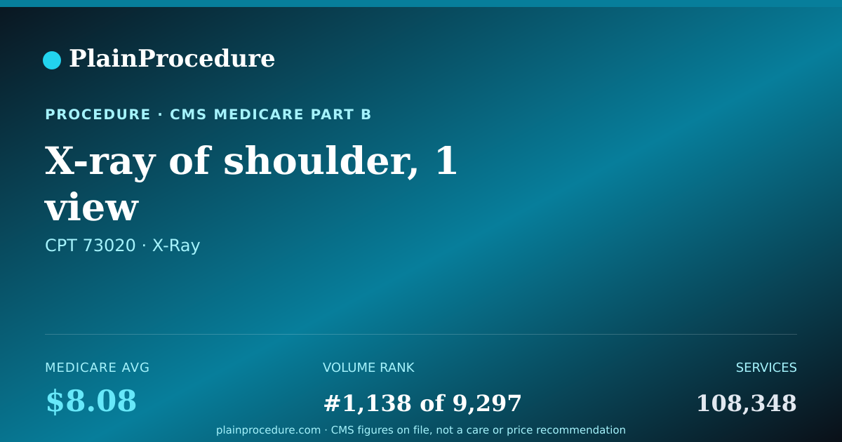 Shareable card for X-Ray Of Shoulder, 1 View