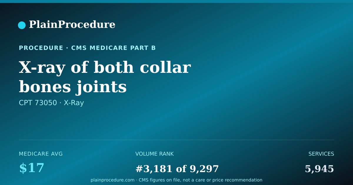 Shareable card for X-Ray Of Both Collar Bones Joints