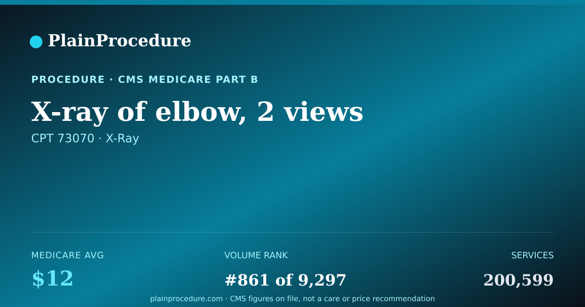 Shareable card for X-Ray Of Elbow, 2 Views