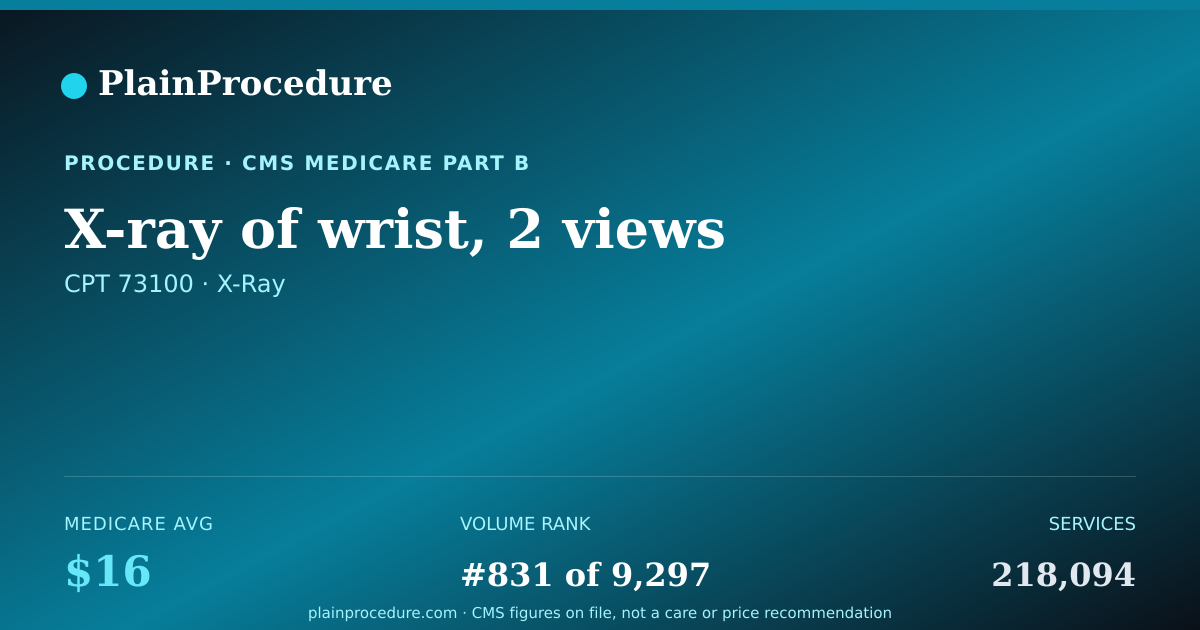 Shareable card for X-Ray Of Wrist, 2 Views