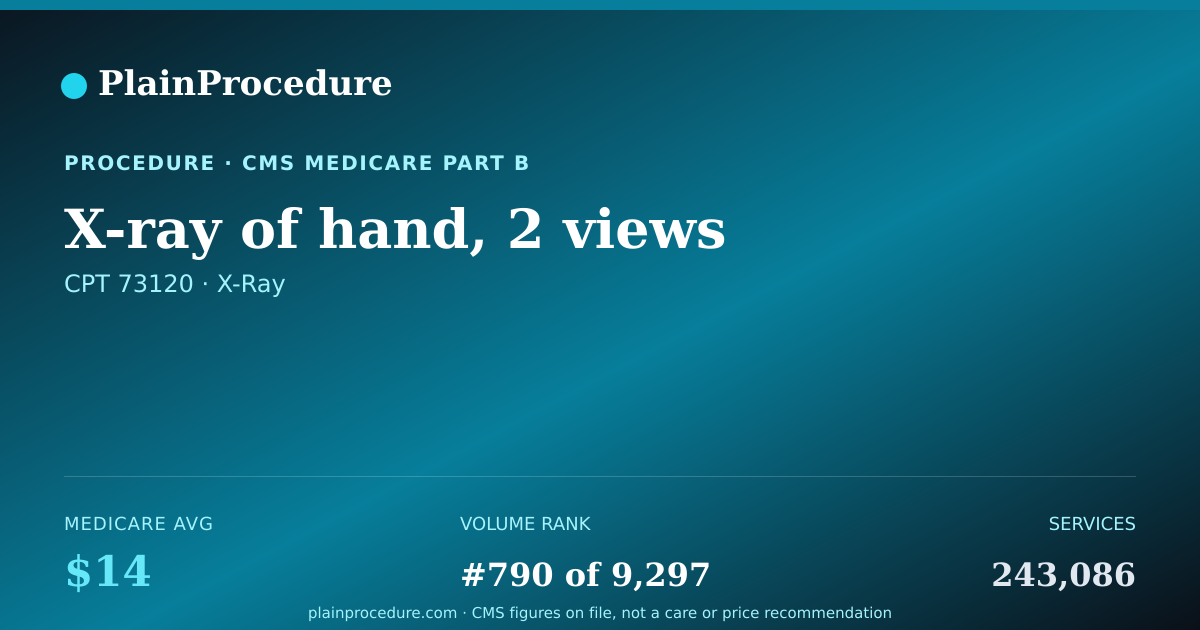 Shareable card for X-Ray Of Hand, 2 Views