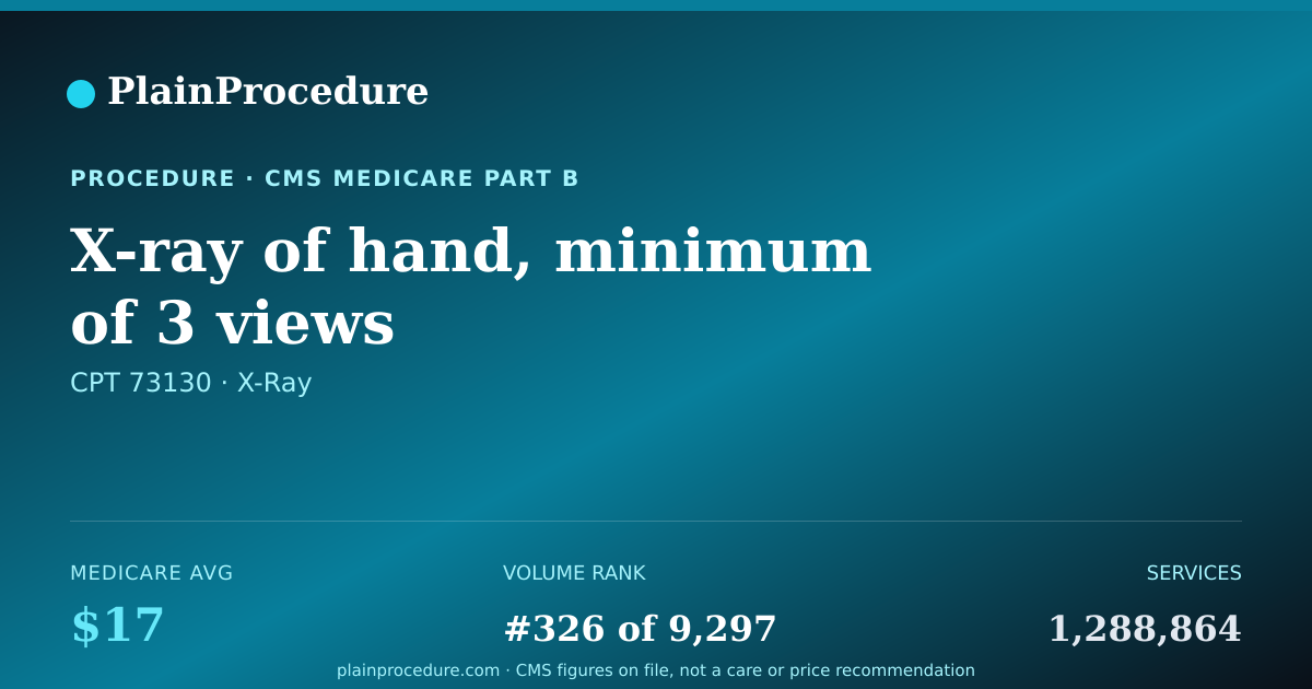 Shareable card for X-Ray Of Hand, Minimum Of 3 Views