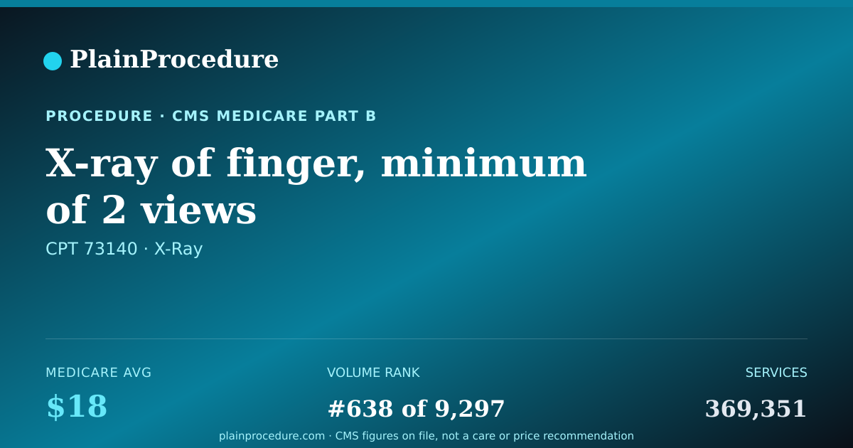 Shareable card for X-Ray Of Finger, Minimum Of 2 Views
