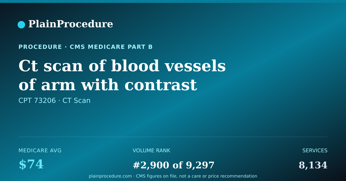 Shareable card for Ct Scan Of Blood Vessels Of Arm With Contrast