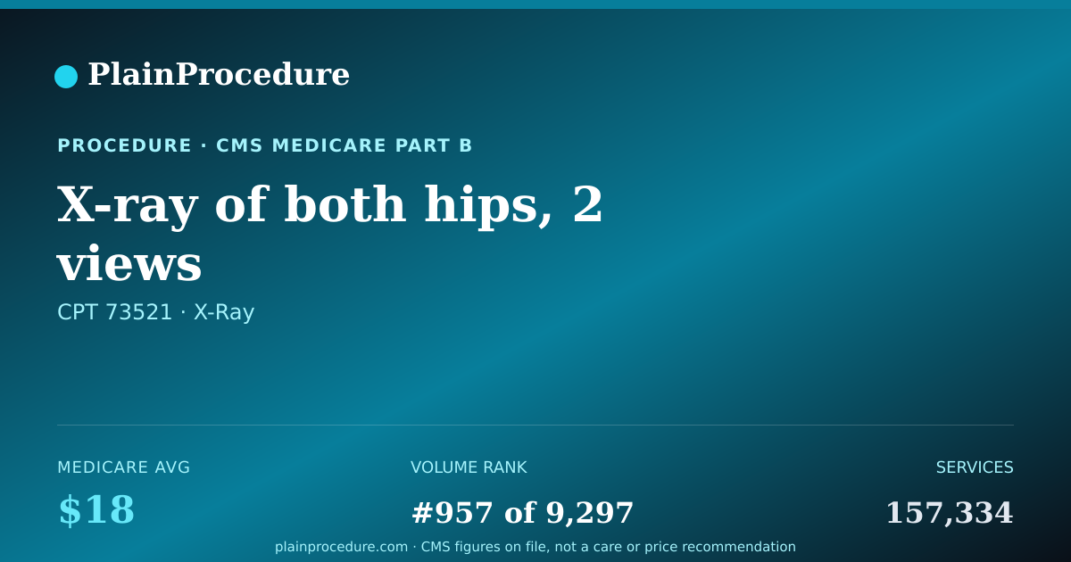 Shareable card for X-Ray Of Both Hips, 2 Views