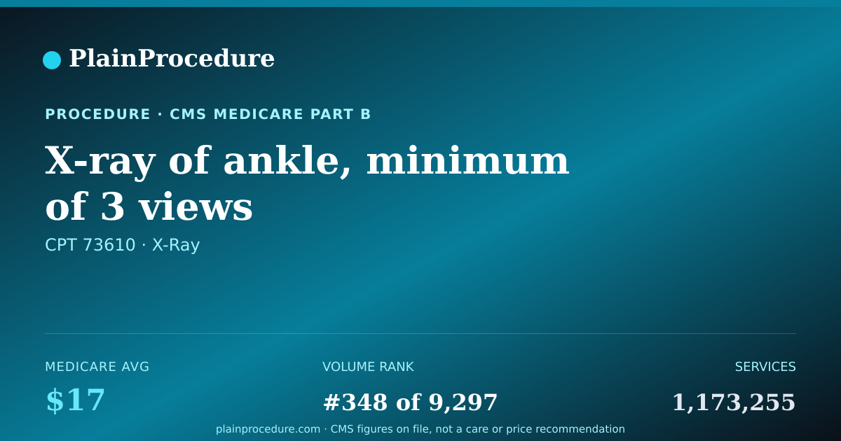 Shareable card for X-Ray Of Ankle, Minimum Of 3 Views