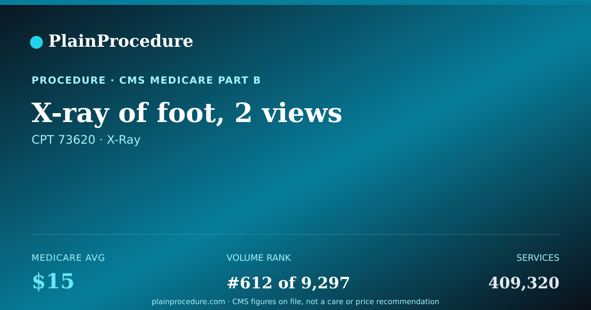 Shareable card for X-Ray Of Foot, 2 Views