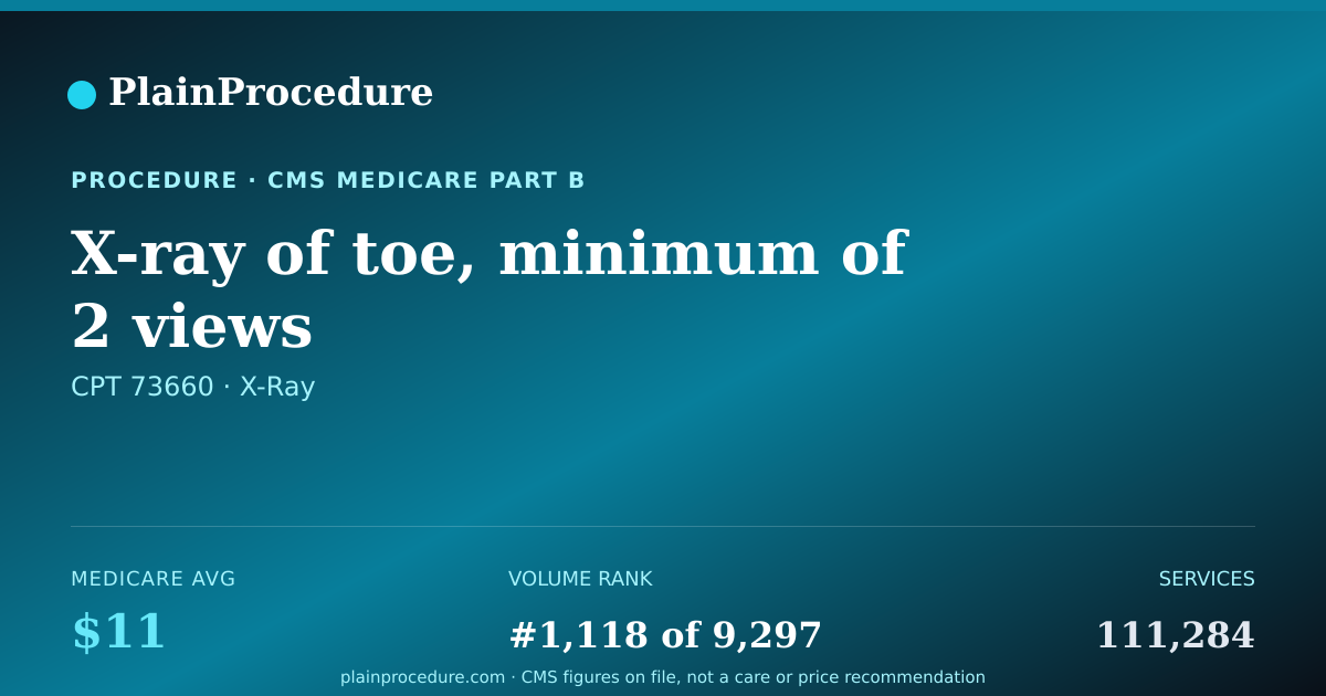 Shareable card for X-Ray Of Toe, Minimum Of 2 Views