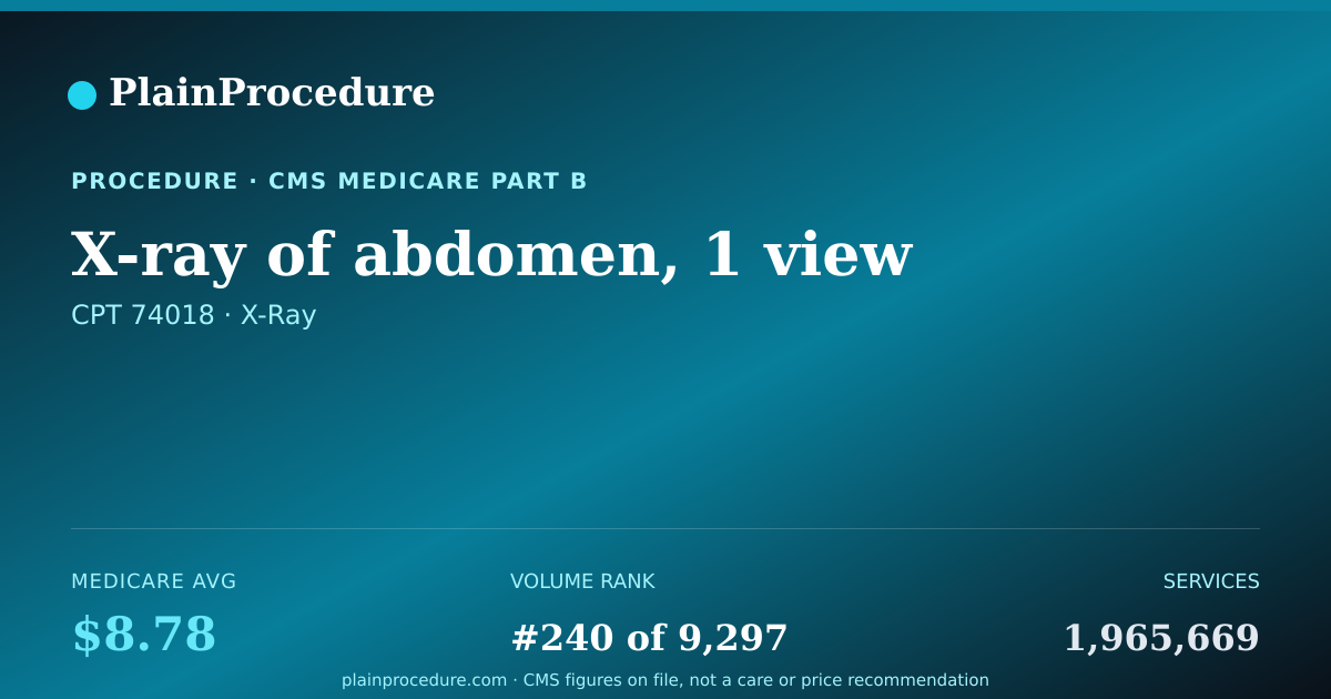 Shareable card for X-Ray Of Abdomen, 1 View