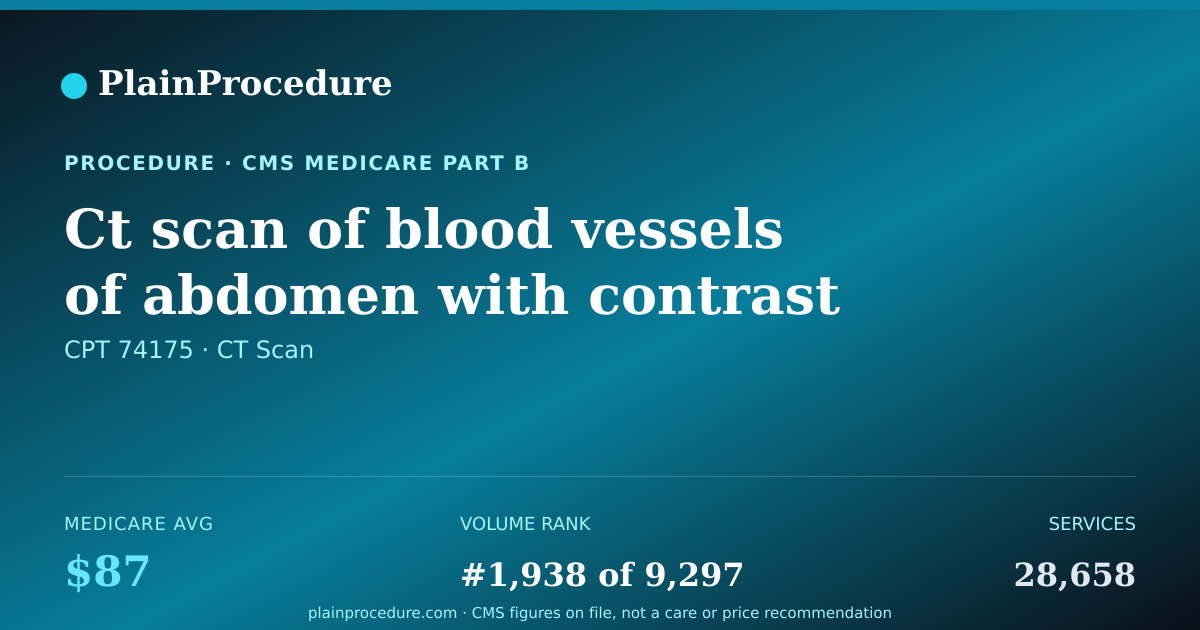 Shareable card for Ct Scan Of Blood Vessels Of Abdomen With Contrast