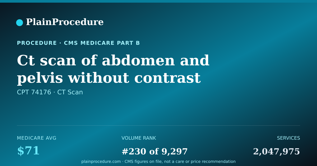 Shareable card for Ct Scan Of Abdomen And Pelvis Without Contrast
