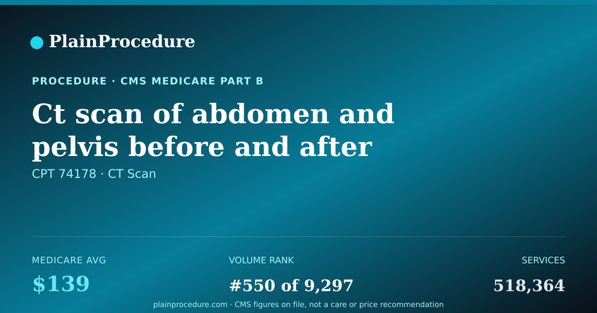 Shareable card for Ct Scan Of Abdomen And Pelvis Before And After Contrast
