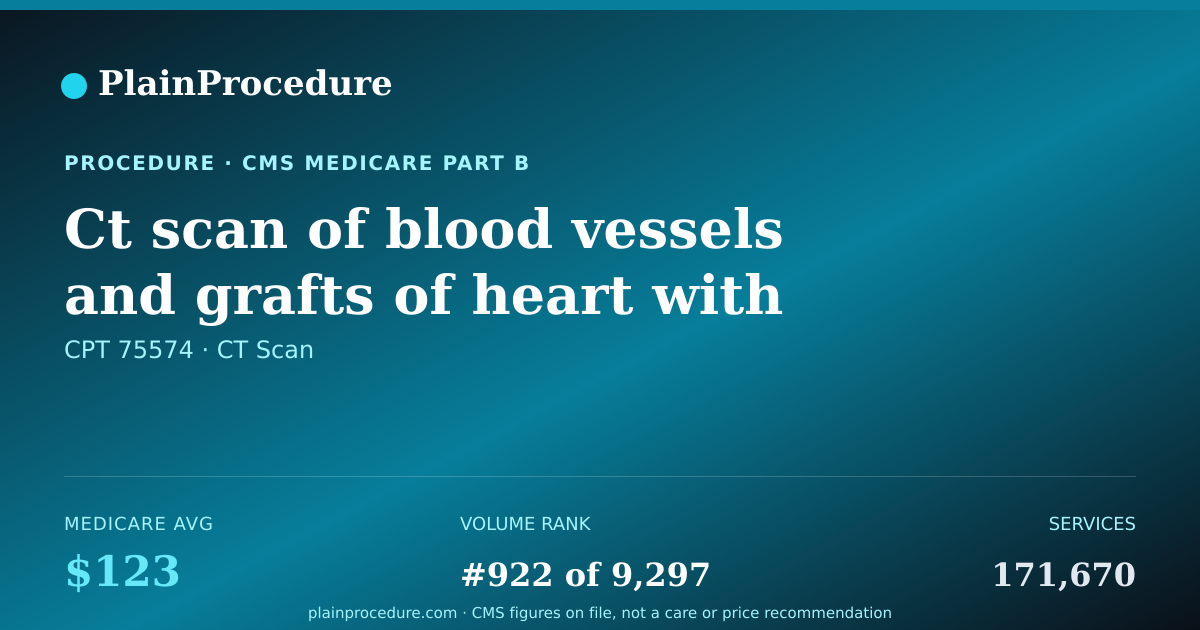 Shareable card for Ct Scan Of Blood Vessels And Grafts Of Heart With Contrast