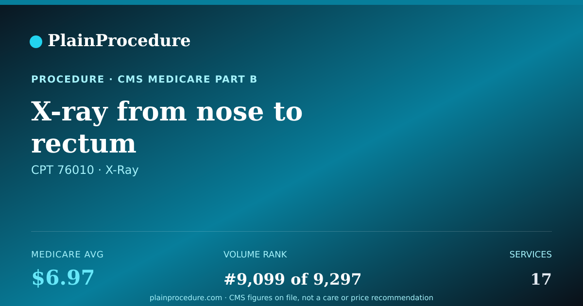 Shareable card for X-Ray From Nose To Rectum