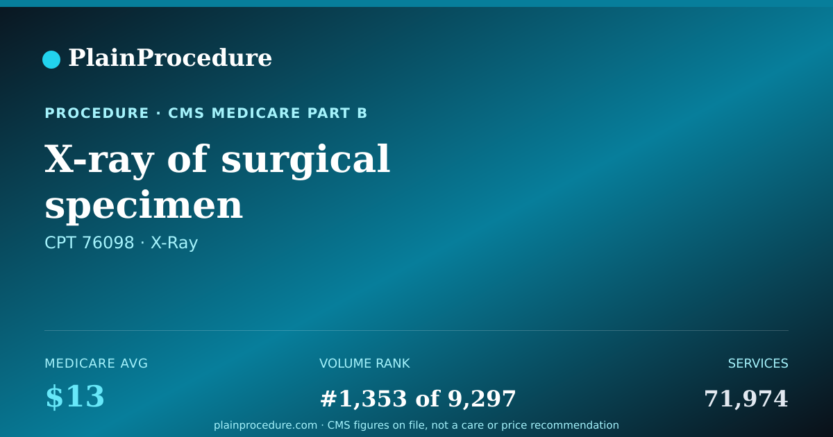 Shareable card for X-Ray Of Surgical Specimen